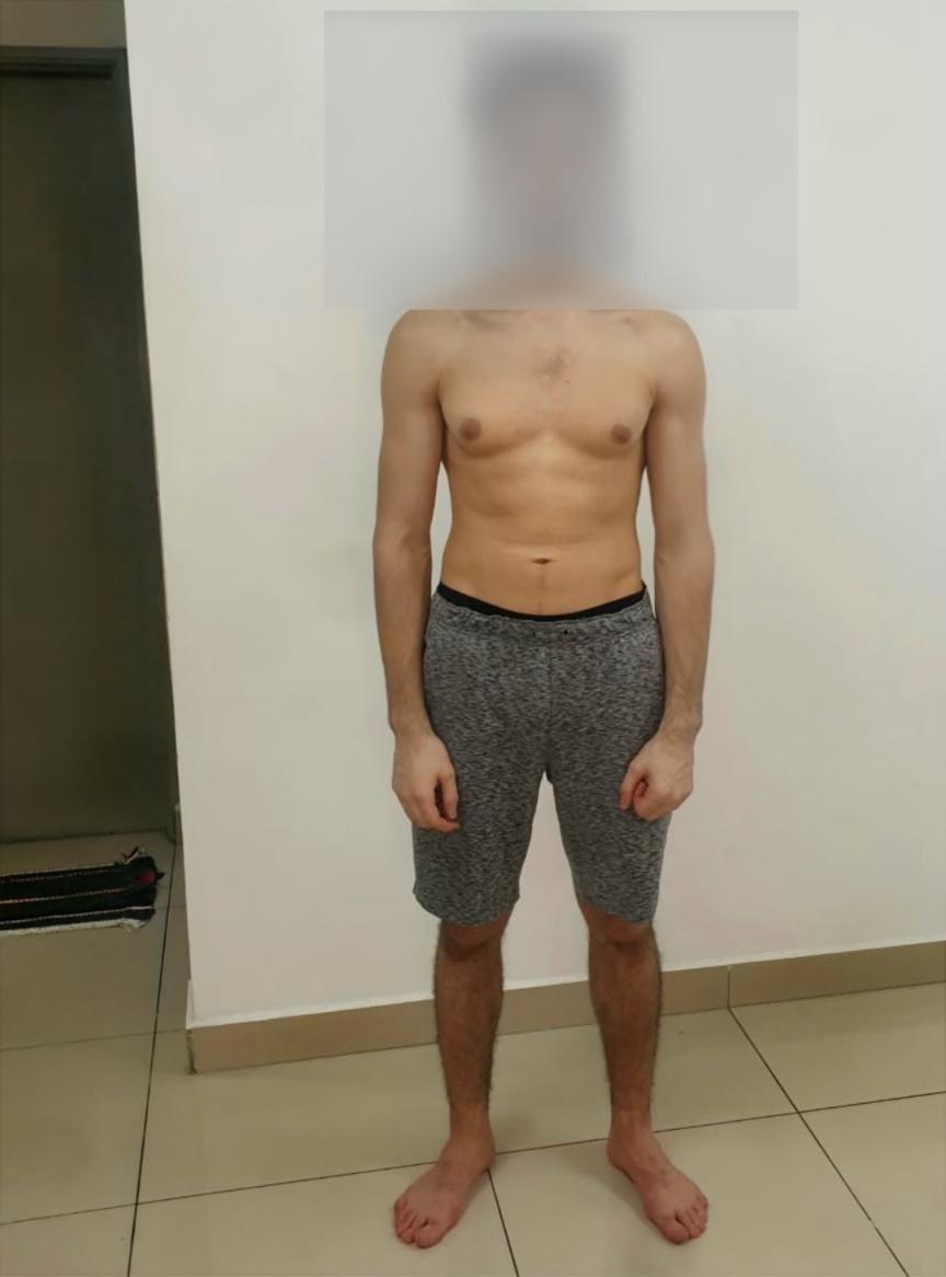 نتائج في 3 أشهر — قبل | Basel Fit System