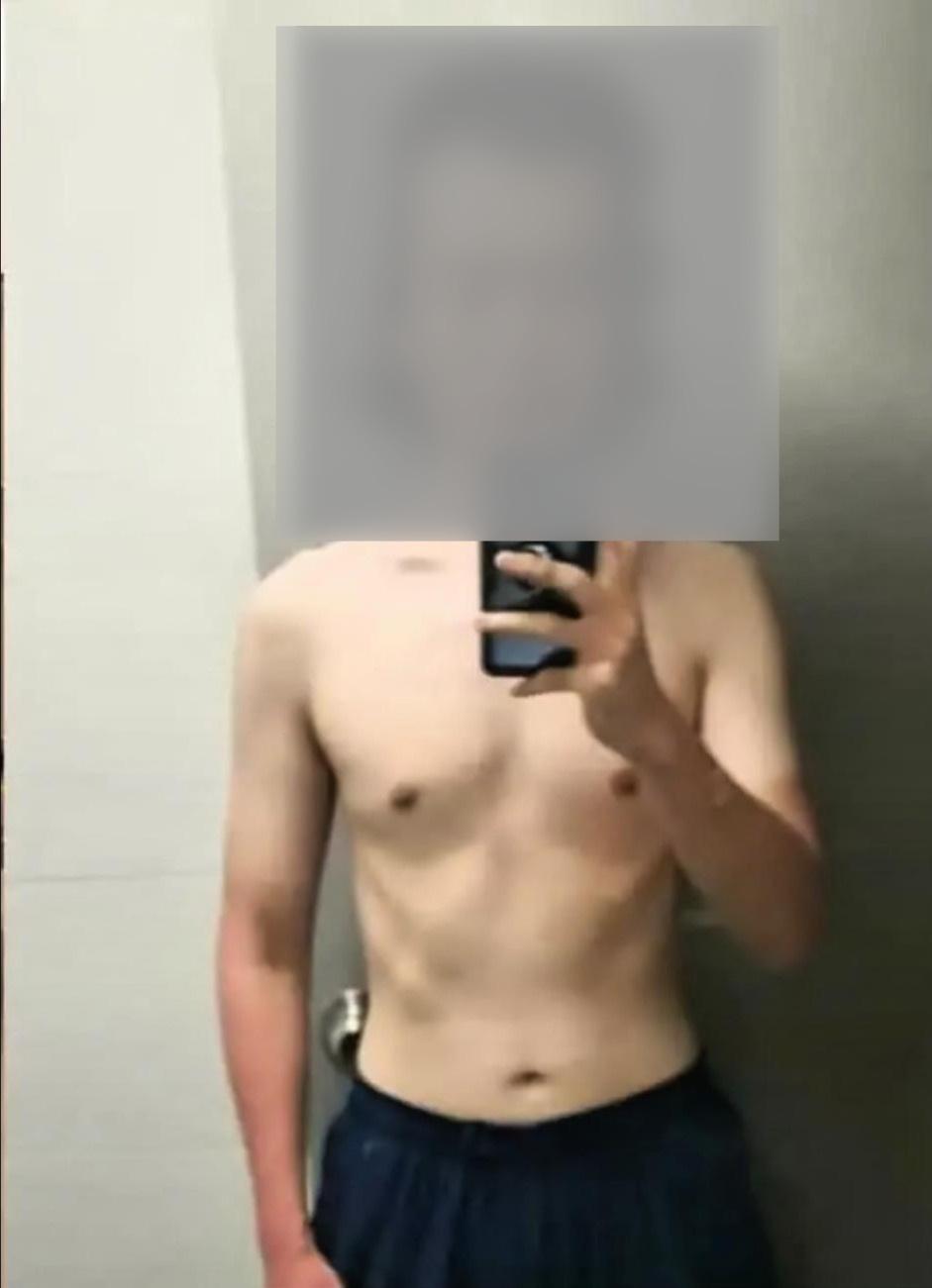 نتائج في 3 أشهر — قبل | Basel Fit System