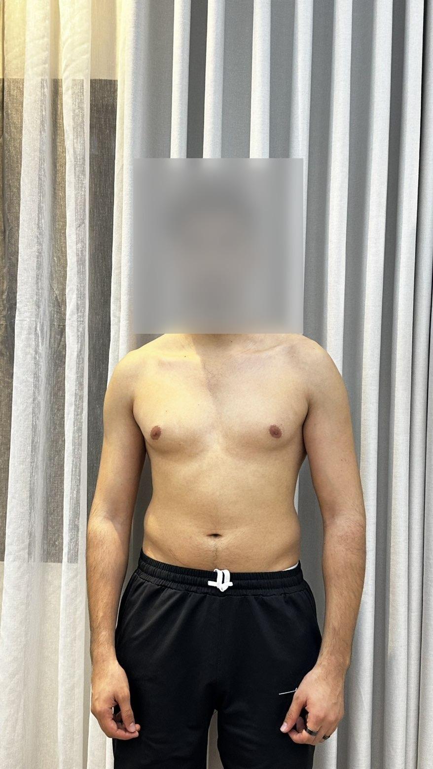 نتائج في 3 أشهر — قبل | Basel Fit System