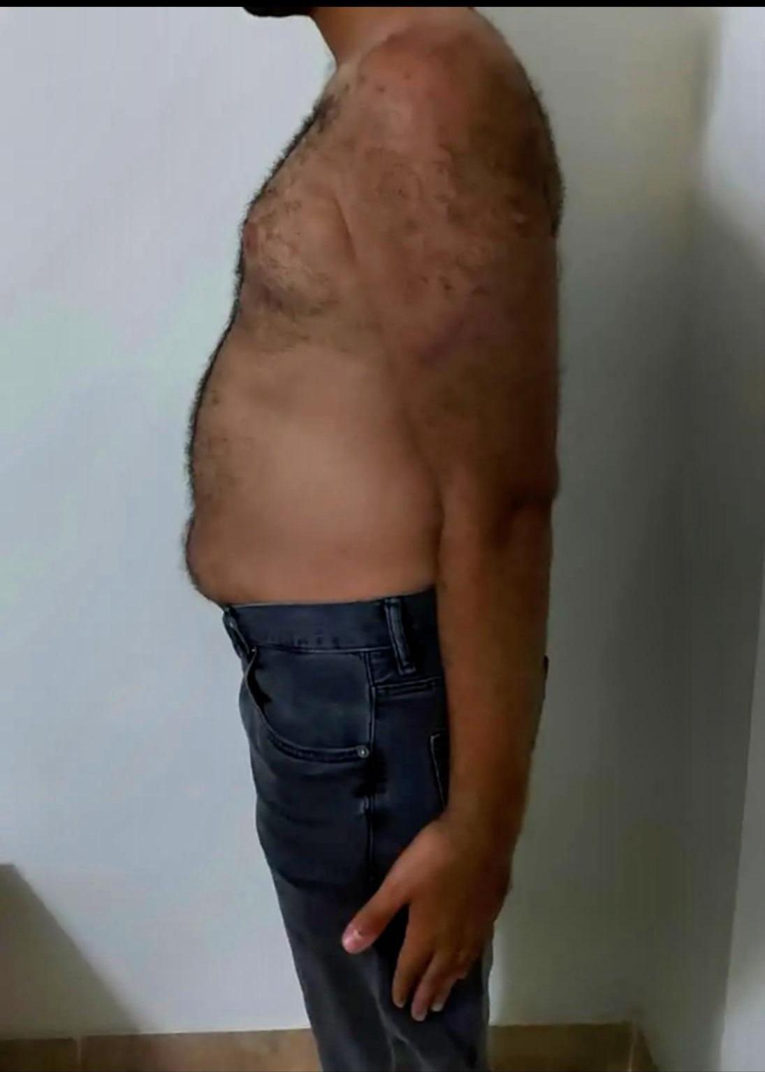نتائج في 3 أشهر — قبل | Basel Fit System